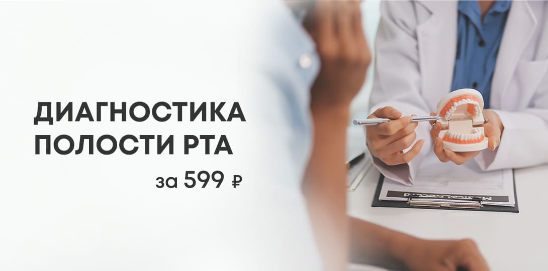 Диагностика полости рта за 599₽