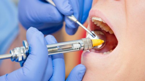 Anesteziya pri lechenii zubov