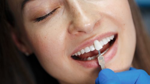 dentist-white-teeth