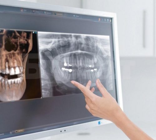Компьютерная дентальная 3D-томография